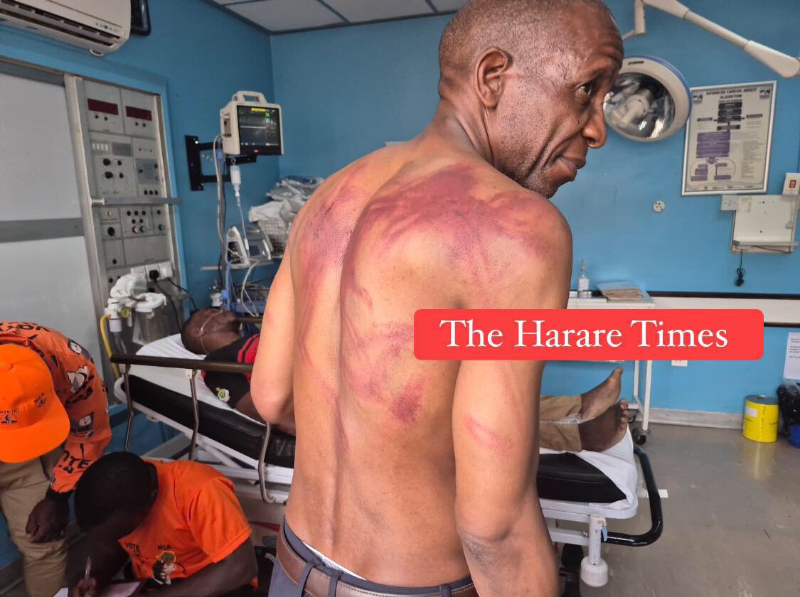 Are these the consultations? Why deny people the right to participate in constitutional processes? You want to torture us to 2030?