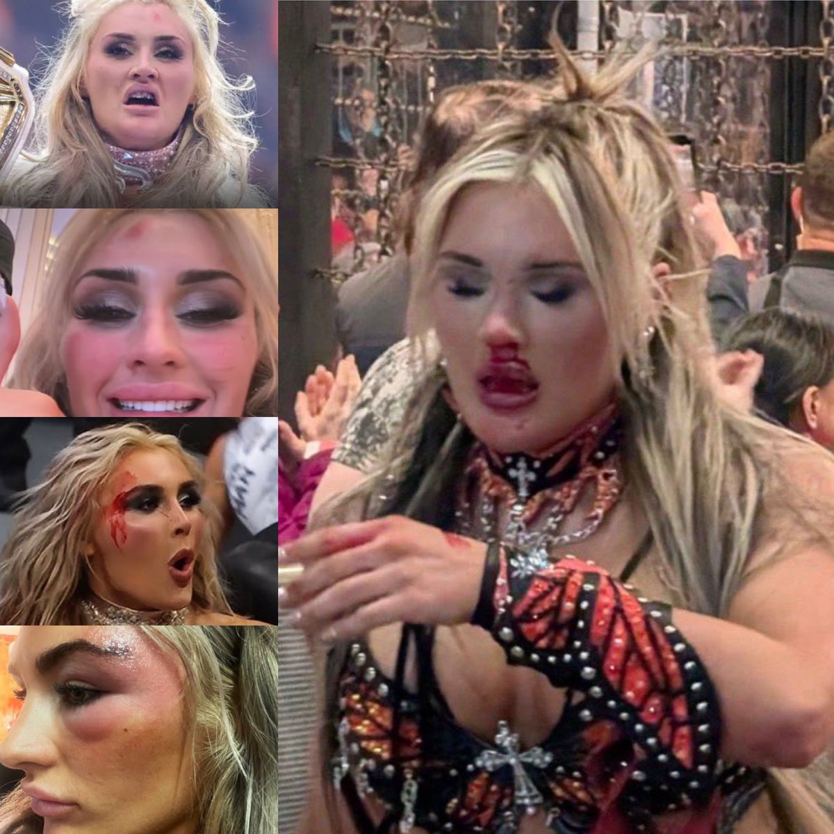 Tiffany tuff time be getting fked up after her matches 😭