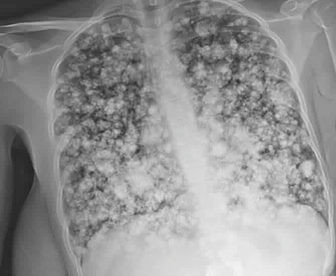 Medzonetv tweet media