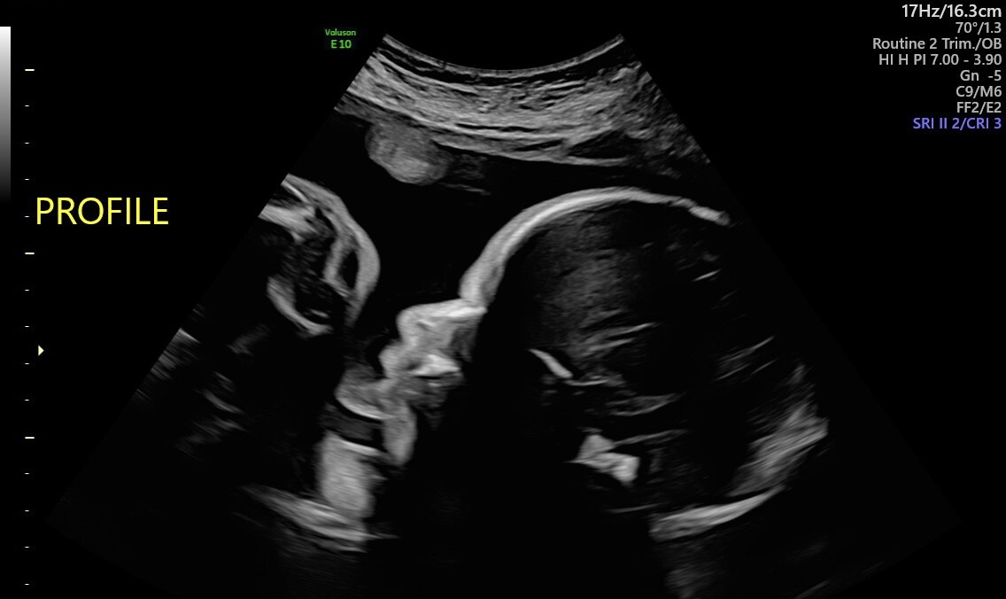 Mati Allin tweet media