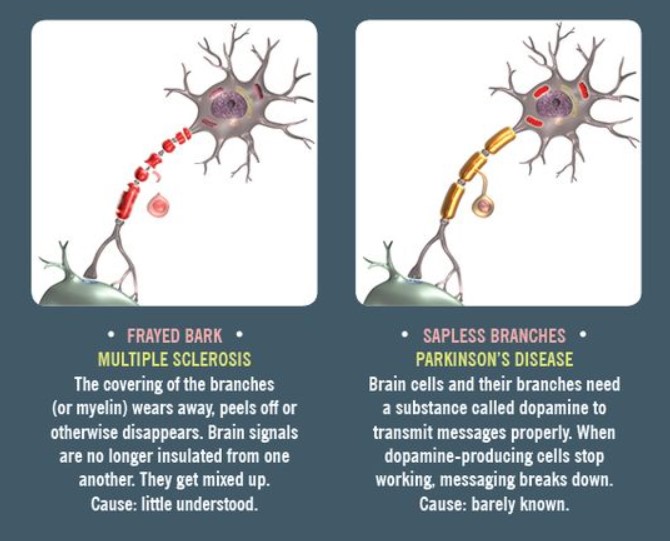 Neuron Powers 🧠 (@neuronpowers) on Twitter photo 