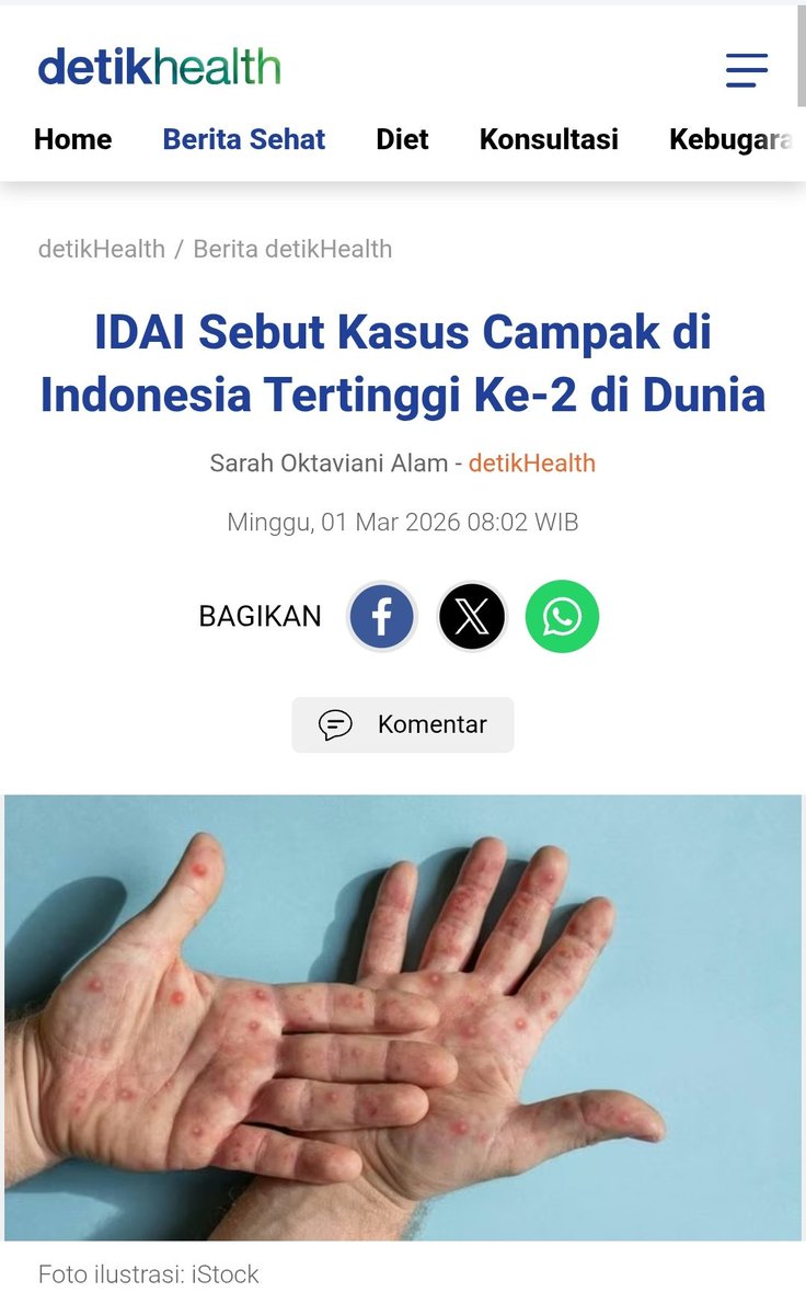 🚨Indonesia KLB Campak

Ketua Ikatan Dokter Anak Indonesia (IDAI) Jawa Barat, Prof Dr dr Anggraini Alam, SpA, juga menyebut penyebaran kasus campak di Indonesia memang cukup parah.

Prof Anggi juga mengungkapkan kasus campak di Indonesia berada di urutan kedua di dunia. Data IDAI