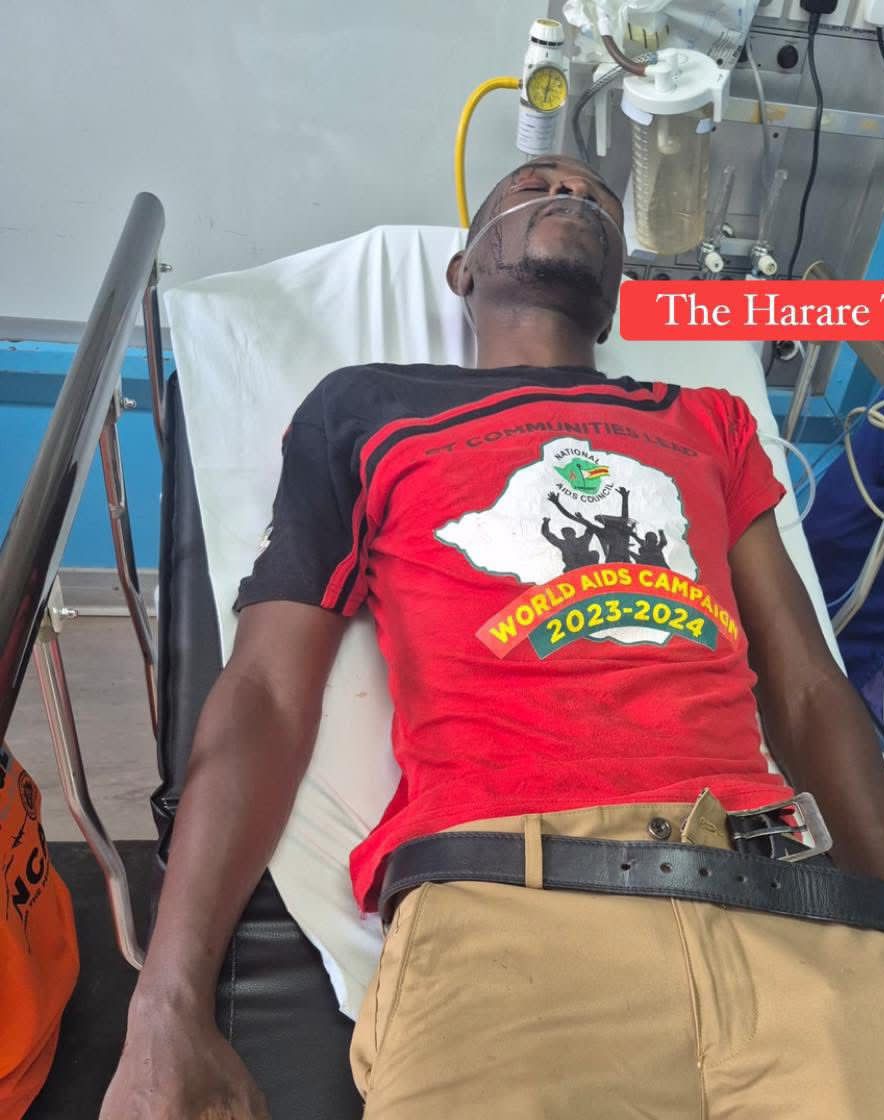 URGENT STATEMENT BY THE CONSTITUTION DEFENDERS FORUM (CDF)
FOR IMMEDIATE RELEASE:

The Constitution Defenders Forum (CDF) strongly condemns the reported assault of Professor Lovemore Madhuku, leader of the National Constitutional Assembly (NCA), at his offices in Harare this