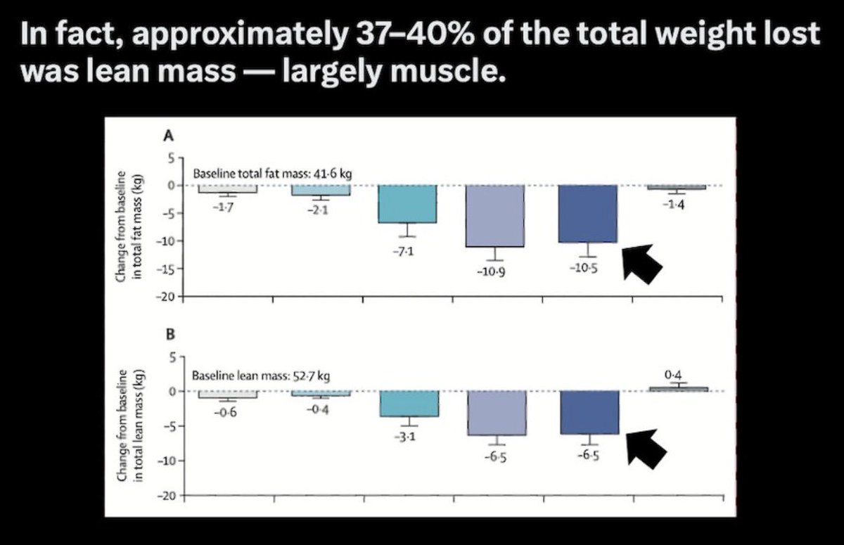 People are claiming Retatrutide (a.k.a. "Reta" a.k.a. GLP-3) causes massive weight loss while “sparing muscle.”

The data disagree. In the published data Reta caused ~6.5 kg (~14 lbs) lean mass loss. That's 38% weight loss as lean mass.