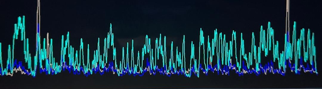 SleepDelish's tweet photo. PTSD is a Spectrum Disorder? Why Alpha Theta Neurofeedback Just May Prove It
https://t.co/mjZV6rioBY https://t.co/oz3JqSQNrO