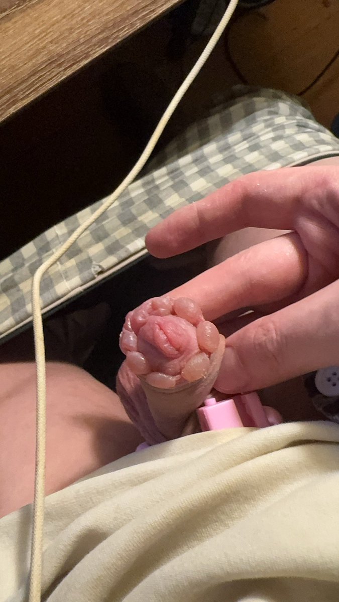 锁m废狗 tweet media