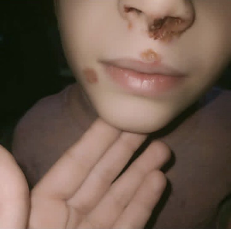 I WILL DIE😭 

Unfortunately, my poor little my daughter  body is full of pimples and I can't do anything for her. She urgently needs your help to provide tr

3 replies — even dots — can break the
 algorithm😭

gofund.me/62fb9062d