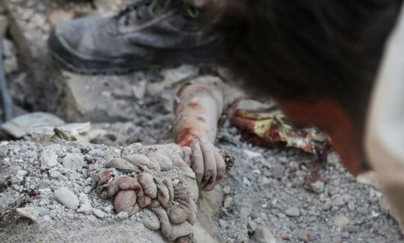🚨Asciende a 165 la cifra de niñas asesinadas en la escuela de Minab (en el sur de #Iran) a causa del bombardeo sionista-estadounidense, lanzado el sábado. 

🔴El fiscal local ha anunciado este nuevo balance además de precisar que hay otras 96 heridas por la agresión terrorista.