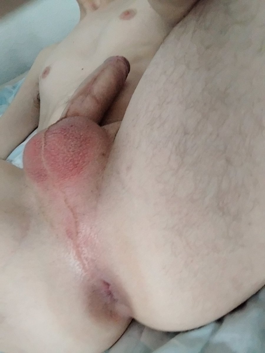 Minet versa tweet media