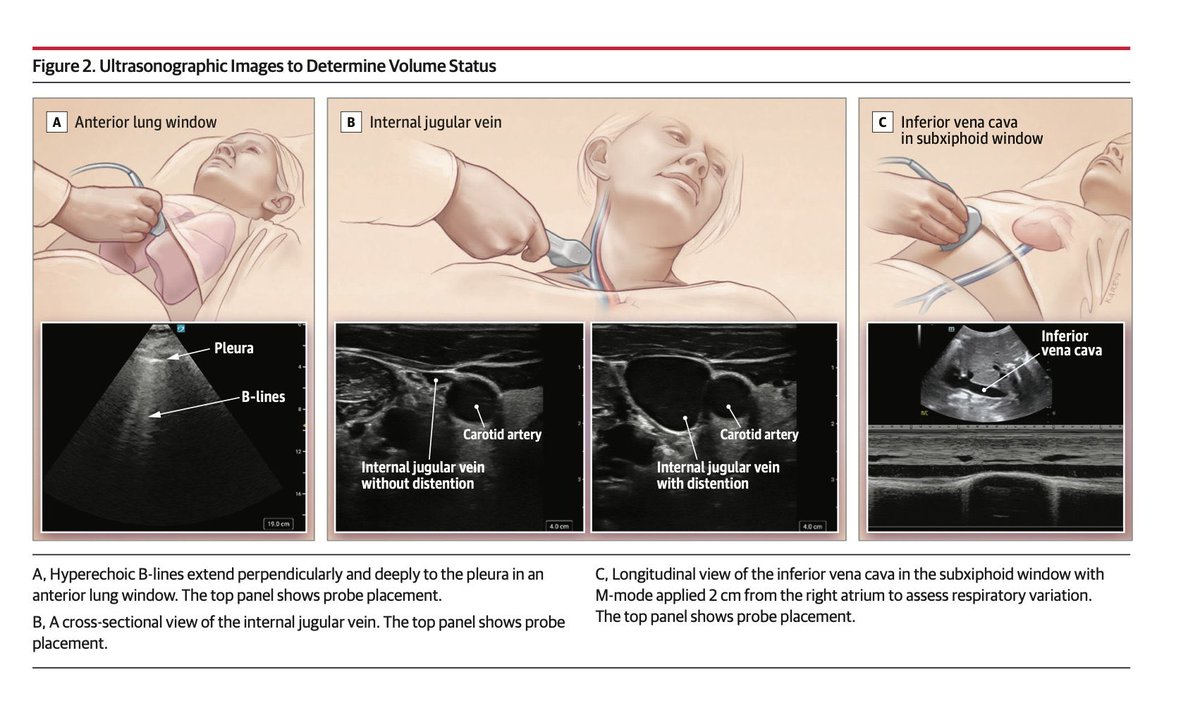 Edgardo Alania tweet media