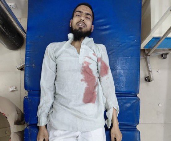 Big Breaking 🚨
He is Mohd Zeeshan who slit the throat of YouTuber Saleem Wastik, he has been killed by UP police like a rat

If you like Yogi ji's police work, Follow <a href="/Voiceofhindus/">Voice of Hindus</a> for more such content 🙏🏻