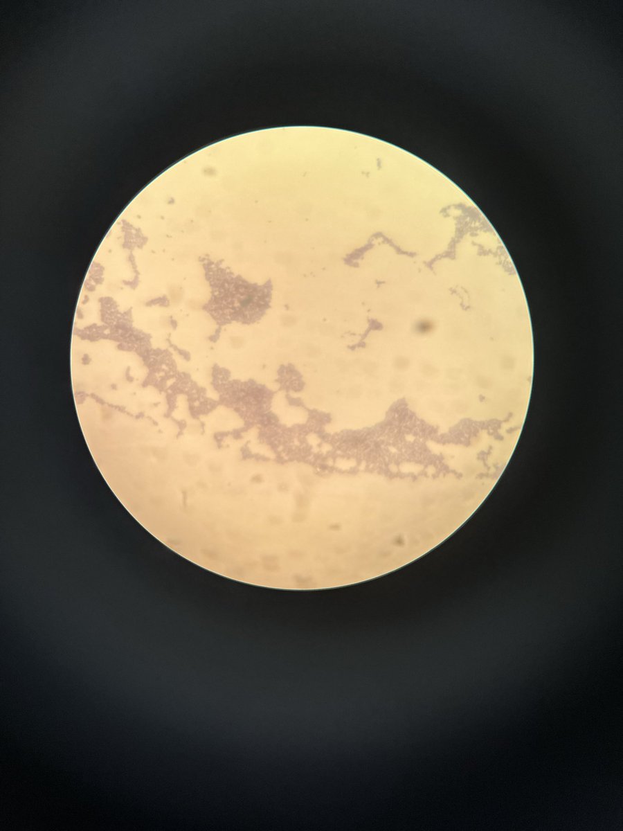 من معمل المايكرو 
الغريب ان البكتريا م انصبغت زين وتوقعت صبغي غلط بس طلع البكتريا نفسها م اخذت الصبغه والي اخذو من نفس العينه حقتي  طلع لهم كذا بعد 🧫