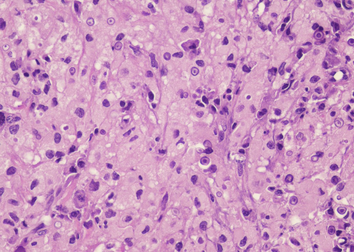 Andres Matoso tweet media