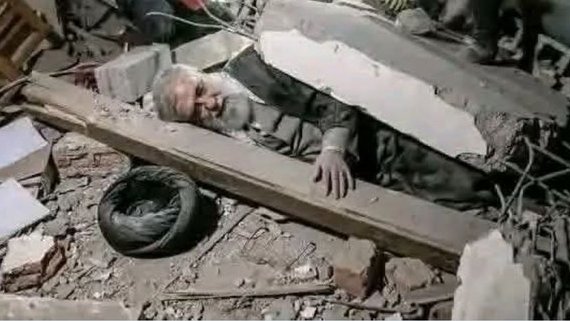 Dayı kadınların saçıyla kıyafetiyle uğraşırsan böyle olursun