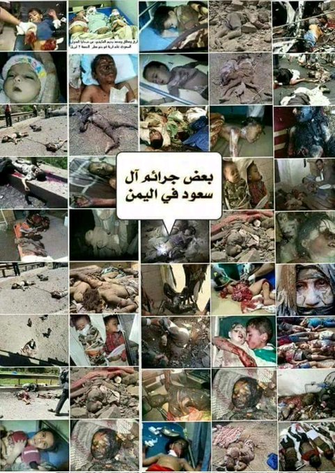 في اليمن كانت تقتل أطفالناطائرات أف16 يقودهاطيارسعودي إماراتي قطري

دكت بيوت الأبرياءوصالات الأفراح والعزاء والمدارس والمستشفيات وانتشلناجثث أطفالنامن تحت الركام وكل يمني حريعلم هذا

ولم نرى إيرانياواحدفي اليمن لافي الجو ولاالبر ولاالبحر
#العدوان_السعودي_الأميركي_الاسرائيلي