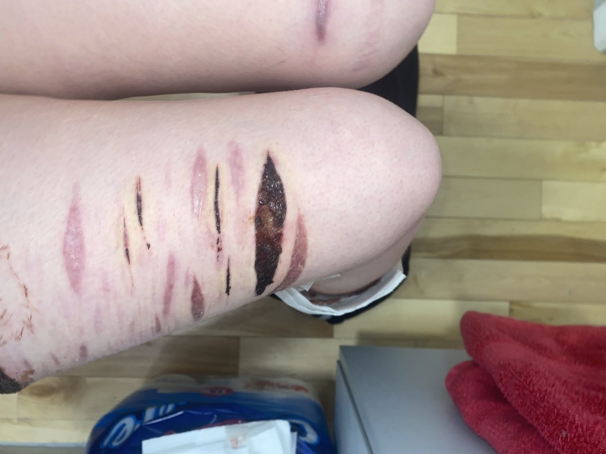 chuuya of shtwt 🩸🐷 tweet media