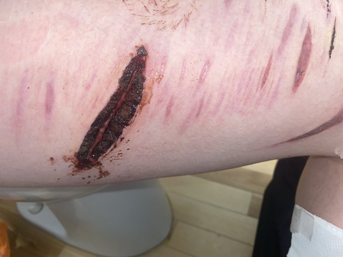 chuuya of shtwt 🩸🐷 tweet media