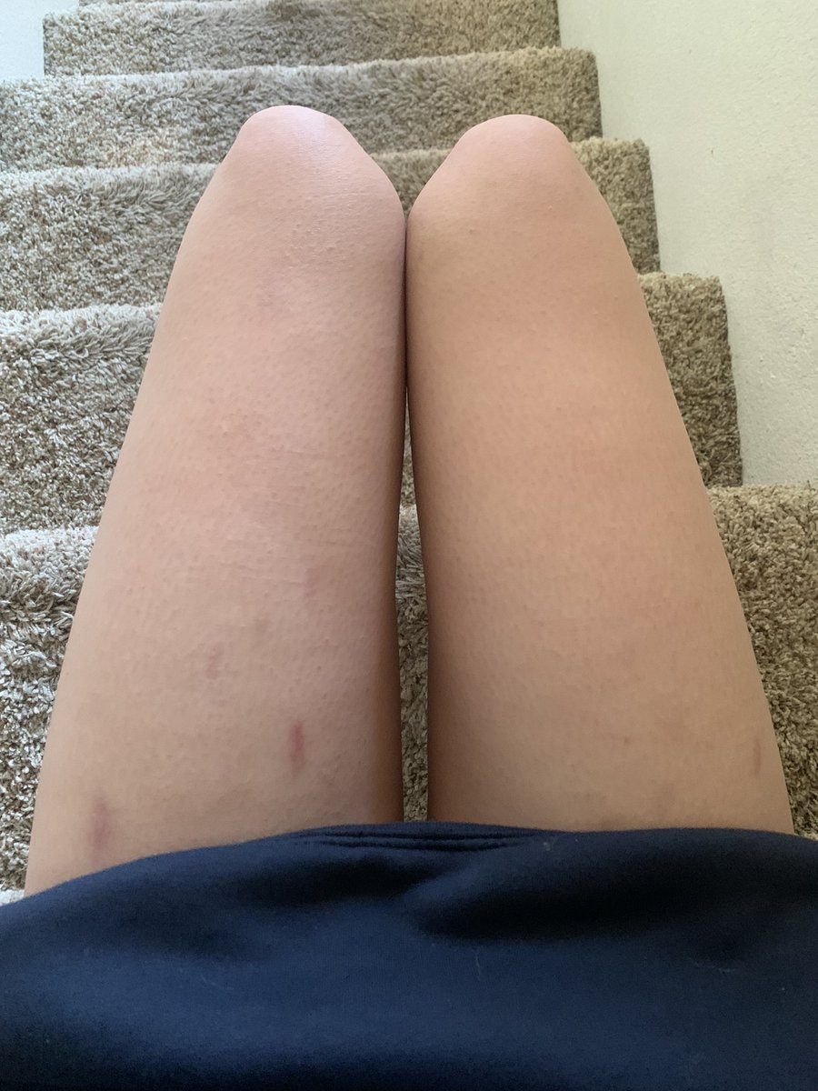 opalbonezs's tweet photo. maybe one day i’ll see a difference https://t.co/iF8NCFb0xk