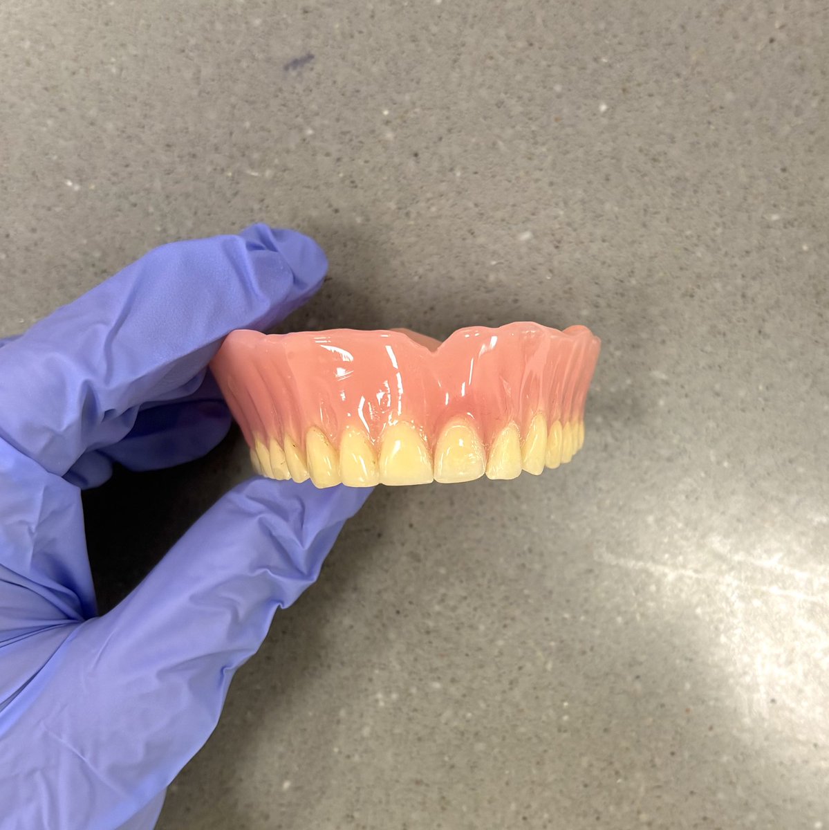 blcspot's tweet photo. Denture repair, before and after 🤌🏻 https://t.co/a4z98SyZBo