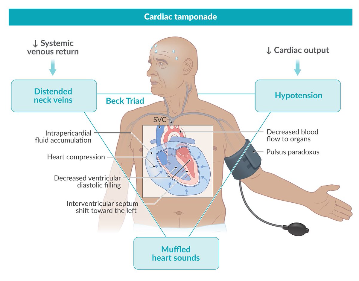 CardiovascularCorner tweet media