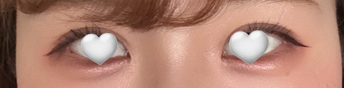 honobobo__oo's tweet photo. DT9日目👀
だいぶ良くなってきたのでは！？！急に腫れひいてくる！！求めてた二重幅😭
#埋没 #整形垢さんと繋がりたい #整形 #埋没レポ https://t.co/2zvhqtmH5G