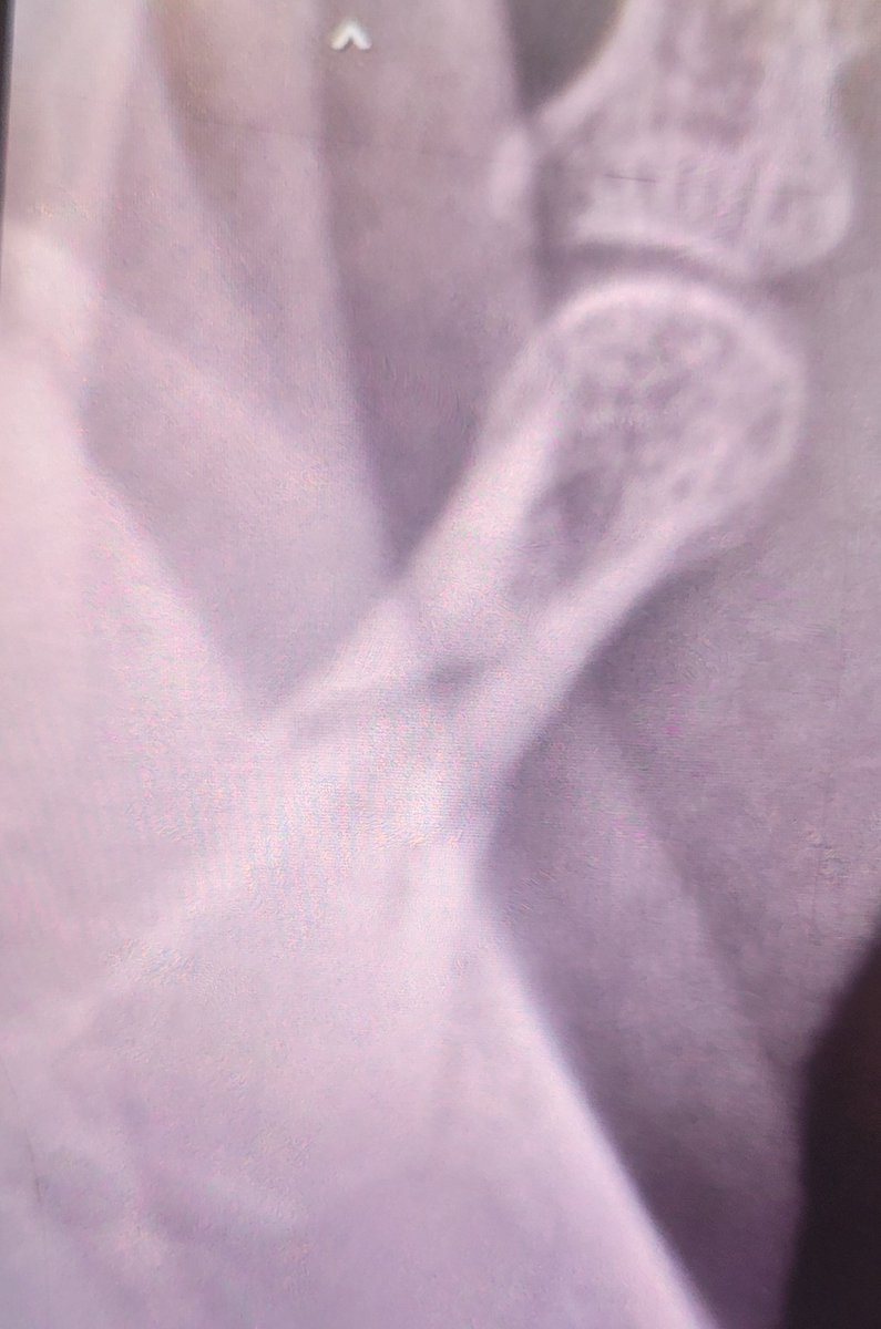 Gray Foxx tweet media