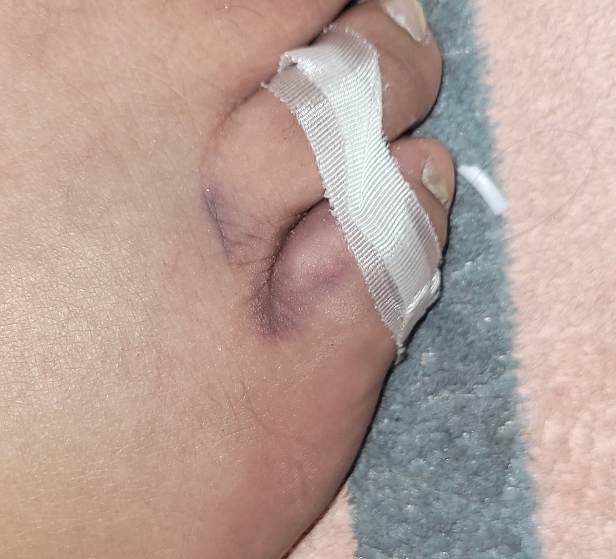 Gray Foxx tweet media