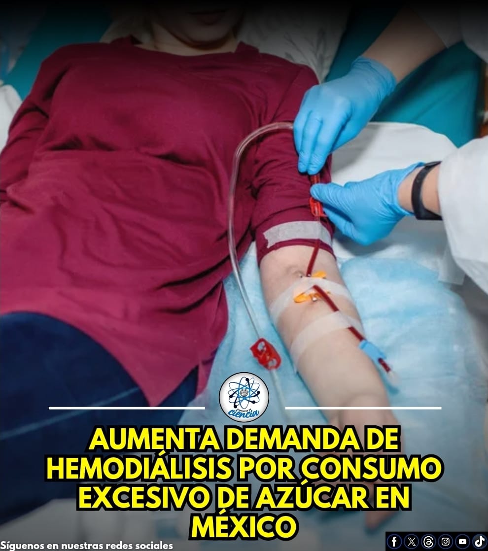 En México, la demanda de hemodiálisis ha aumentado drásticamente, pasando de 40,000 a más de 100,000 pacientes en una década, impulsada principalmente por la diabetes derivada del consumo excesivo de azúcares y refrescos. Esta crisis de salud, agravada por el consumo de 166