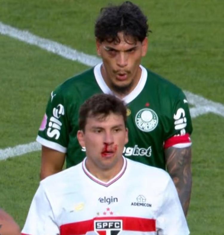 amorimbaiano's tweet photo. gomez sempre tratando esses vermes como eles merecem https://t.co/1Yn8GvMFCI