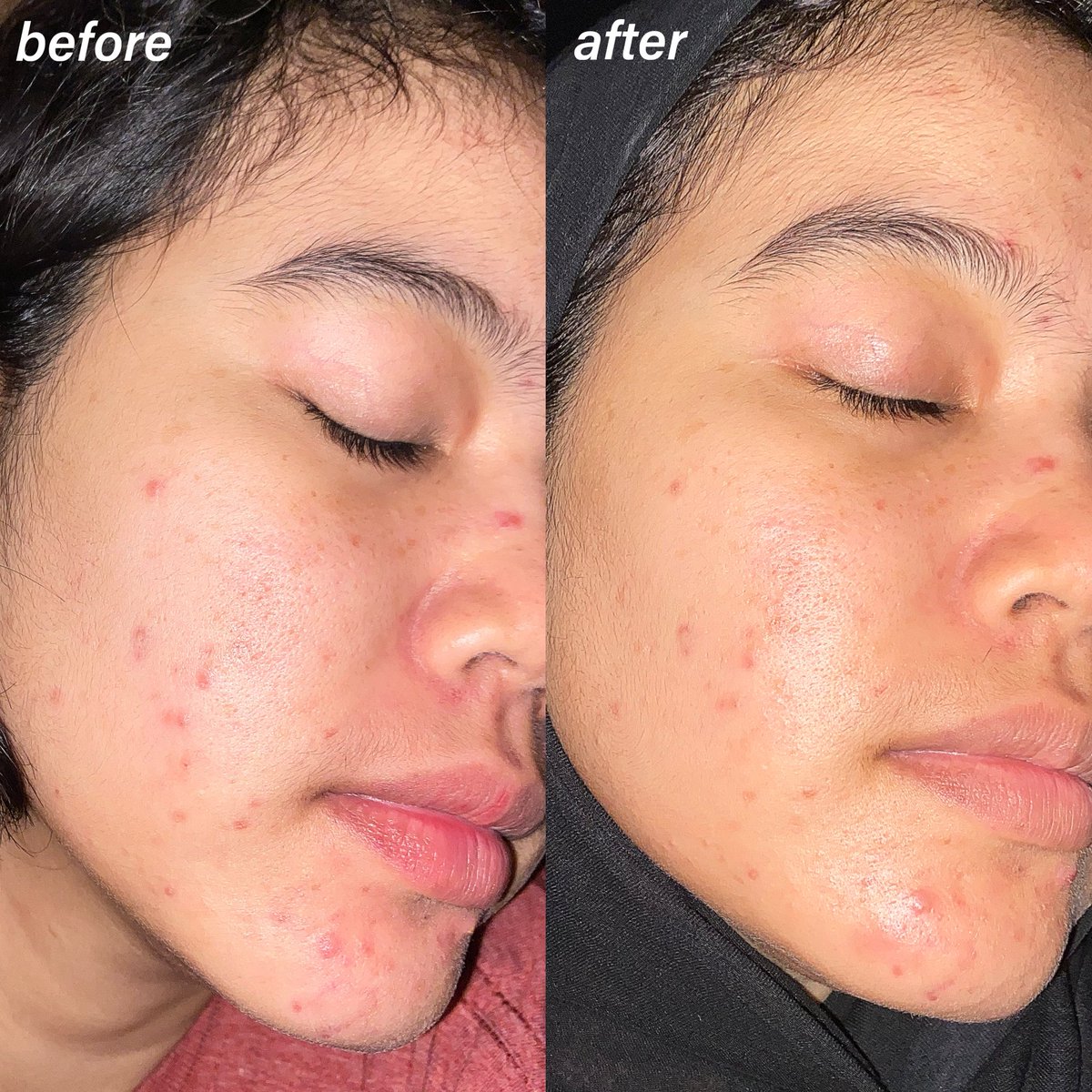 pantesan moisturizer ini tuh seliweran mulu… ternyata di review dokter kulit  dari US woy?!? 😭👍

tapi emg jujur BAGUS BGT