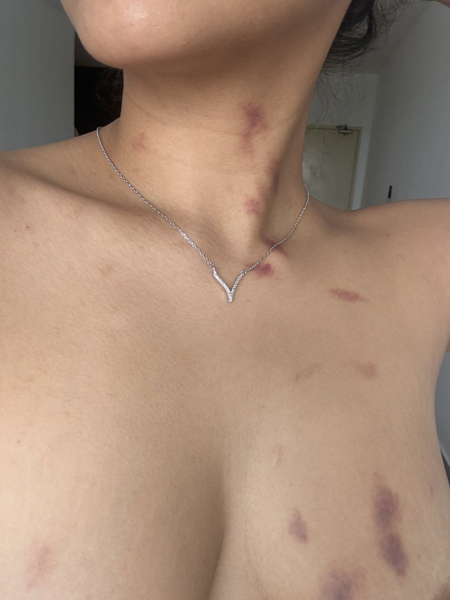 Bellaaaaa🌹 tweet media