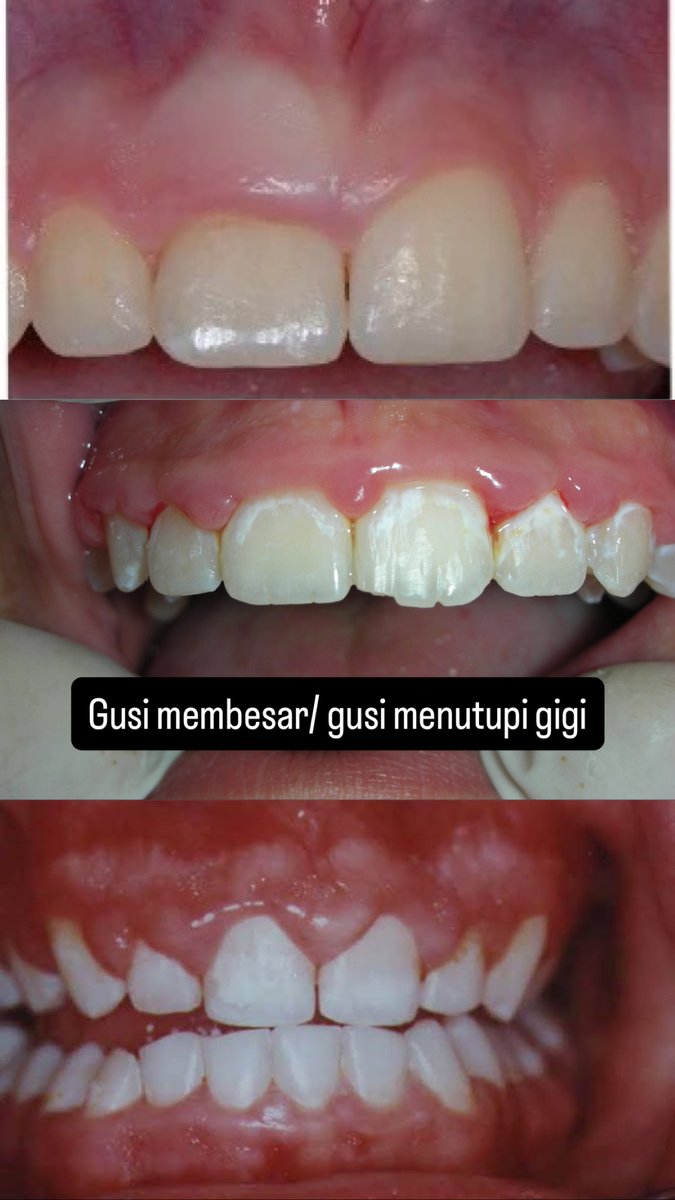 Udinus Menfess tweet media