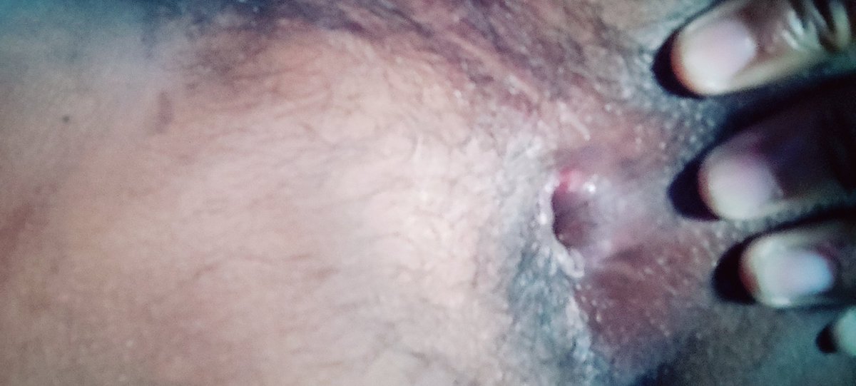 Alpha32848843's tweet photo. My sexy ass hole https://t.co/8PsZpKM4rT