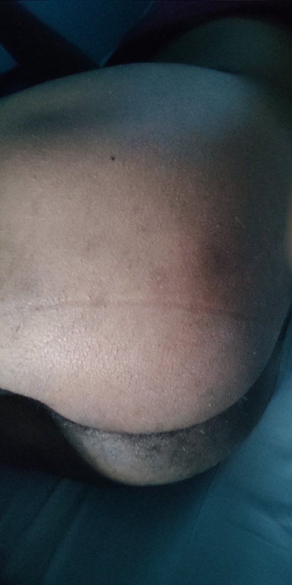 Alpha32848843's tweet photo. @Bullwbenefits @twink_top09 @Tuba0797 @Ritvikkkk1 @mrbull30000 @versarya1000 @CharanbangaramZ @masterjenny655 @upenxstar @AkashhUrs @fair_sameer01 @daddyblackxxl @MonsAnaconda @DesimonsterXx My sexy bubble butt https://t.co/4YEbdMLVVe
