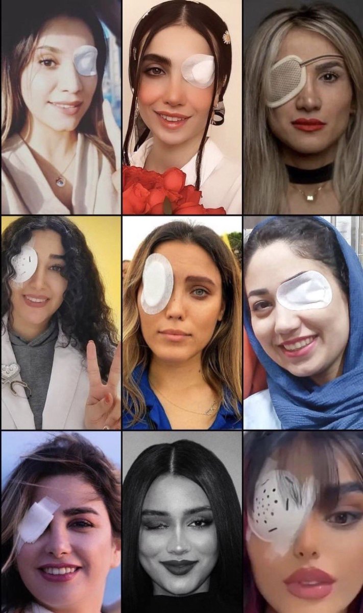 All of these Iranian women were blinded by the Islamic regime in Iran for advocating for women’s rights.

Is this what the far-left is protesting for?