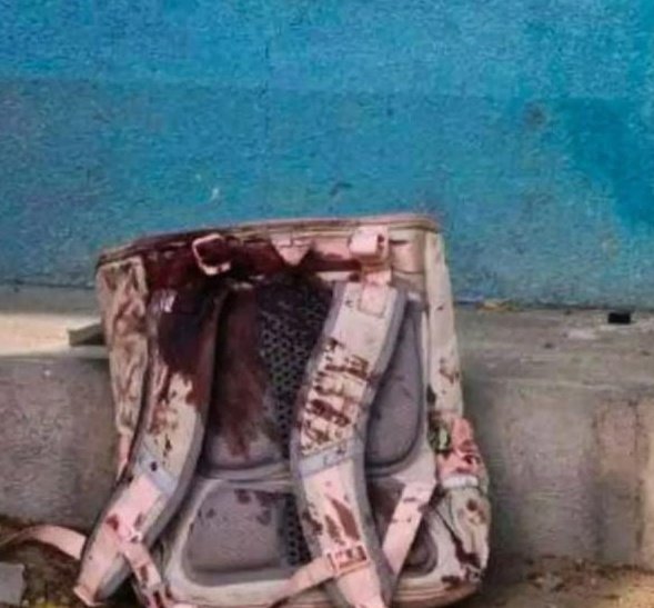 रक्ताने माखलेले हे शाळेचे दप्तर इराणमधील अमेरिका आणि इस्त्रायल ने शाळेवर केलेल्या बॉम्बहल्ल्यात पन्नासच्यावर शाळकरी मुलांचा जीव गेलाय.साम्राज्यवाद्यांची ही न संपणारी भूक?जी निष्पाप लेकरांच्या रक्ताला चटावली आहे ही रक्ताळलेली स्कूलबॅग इस्त्रायली-अमेरिकीअत्याचाराचे प्रतिक बनली आहे.