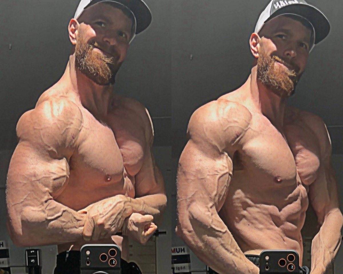 Good morning X

Slept like a rock after feeling absolutely awful all day yesterday. Today everything is back to normal. Stomach fine, no headache. 

Only leftover is a +1.8 kg jump on the scale. 100% cortisol reaction and water nonsense. We’ll see how it settles.

Push workout