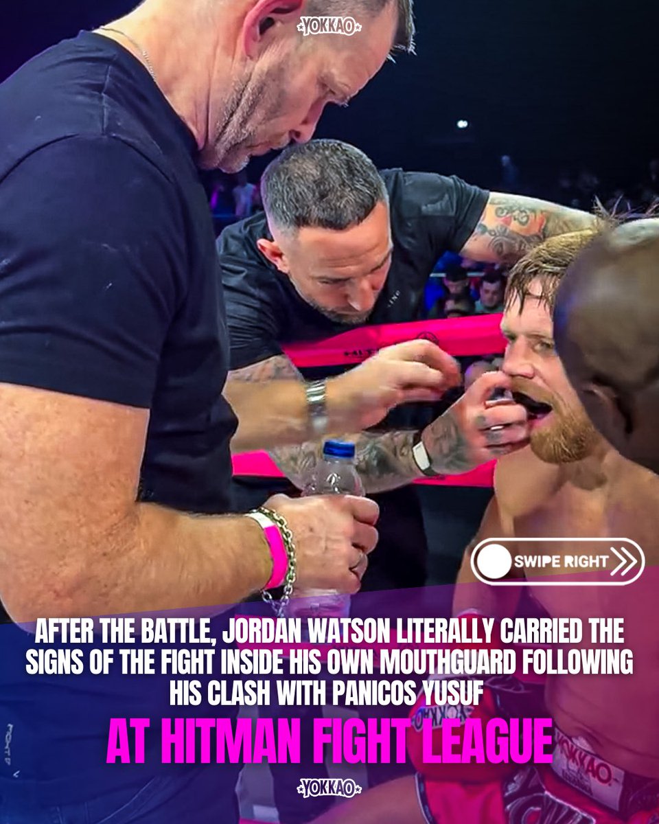 yokkaoboxing's tweet image. Marks of a lifetime in the ring 🥊😮‍💨
After the war at Hitman Fight League, Liam Harrison finds something stuck in Jordan Watson’s mouthguard — his dental implants.
Scars of a career built on battles.
#muaythai #fight #fighting