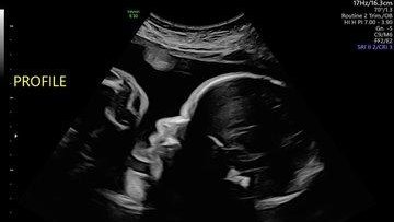 MVS Cryp 🕵️‍♂️💜🍊🌱 tweet media