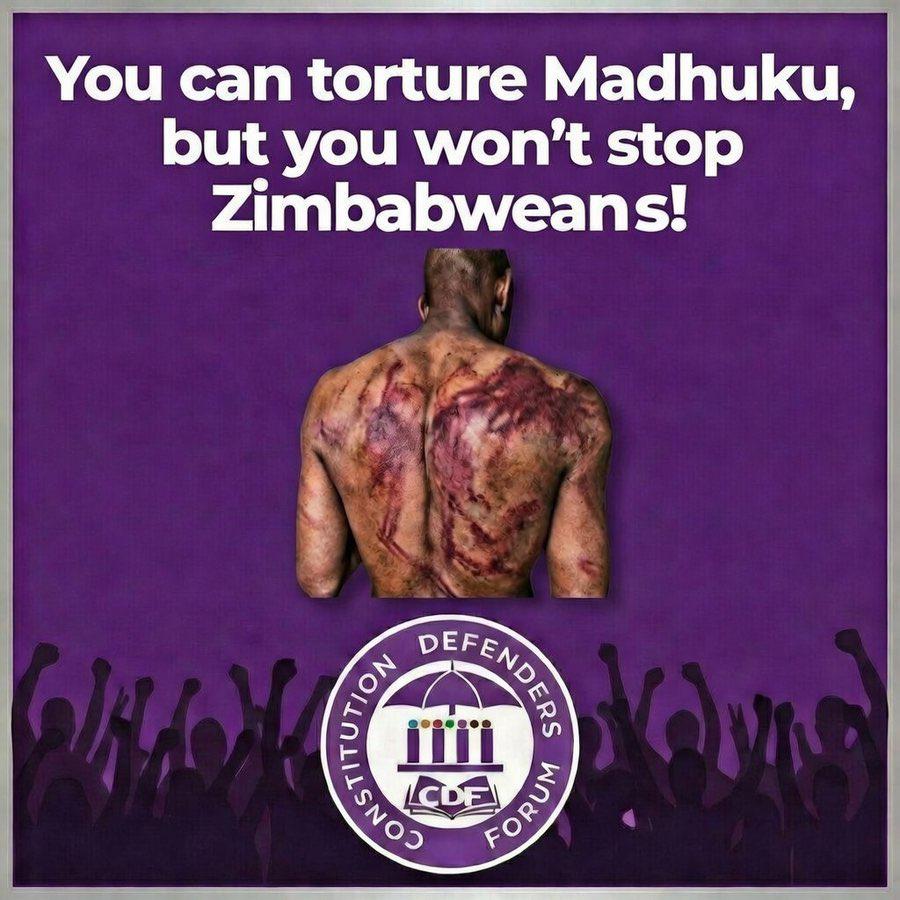 The assault and torture of Professor Madhuku and his NCA members for objecting to the 2030 agenda will not break a resolute Zimbabwe.

You can injure a man, but you cannot injure an idea whose time has come.

When citizens are beaten for demanding constitutional order, it
