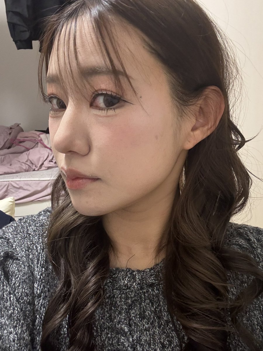 seikeichandayo's tweet photo. @onulpsjapan 輪郭三点＋皮質骨除去＋咬筋縮小＋顎先筋肉引き締め固定 ＋貴族手術
２ヶ月後📝
もううまく笑えるようになってきた！
笑った時の引きつりがましになった！顎らへんは少し麻痺してる🤏
これでもまだ少し腫れてるらしく変化楽しみでしかない！！✨
#onulpsjapan https://t.co/HTAhEGMxGW