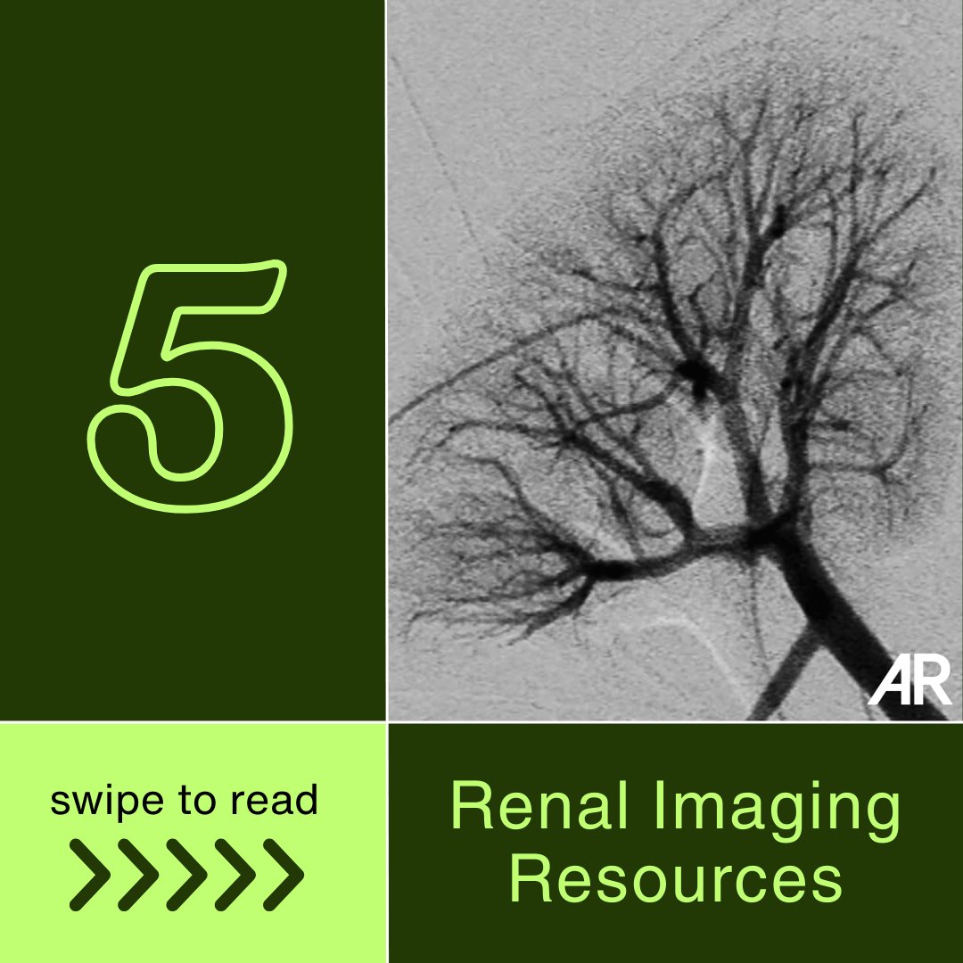 Applied_Rad's tweet image. We're kicking off National Kidney Month with a list of some top articles

1️⃣  bit.ly/4cQtbBG
2️⃣  bit.ly/4u4VW3F 
3️⃣  bit.ly/4aIAE4p 
4️⃣  bit.ly/4r5ixdQ
5️⃣  bit.ly/3PbtWva

#NationalKidneyMonth #Radiology #MedicalImaging #KidneyMonth