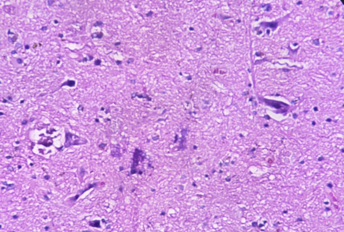 aung phyo tweet media