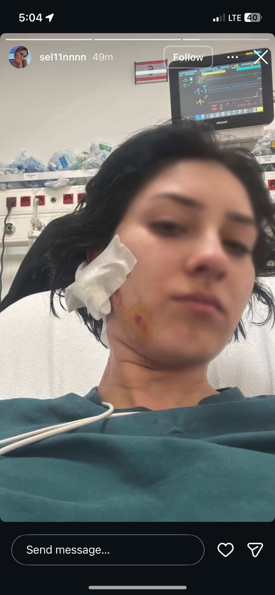 yrnylmz_'s tweet photo. Olay şu serhan selini aldatıyor 3 4 kişiyle bir mekanda öpüşüyor sonrasında selinin evine geliyor öpüştüğünü söylüyor selinde diyorki kendine geldiğinde evden çıkabilirsin arkasını dönünce kızı 45 dakika boyunca darp etmeye başlıyor üzerinde sehpa kırıyor su döküp ayıltıp tekrar+ https://t.co/bl51kFECzN