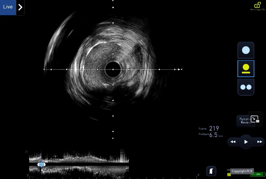 PCRonline 🫀 tweet media