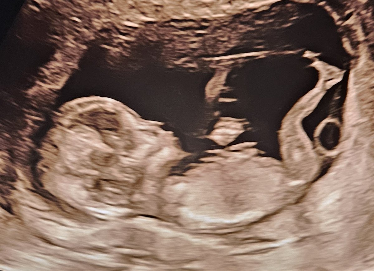 DIF-Europa tweet media