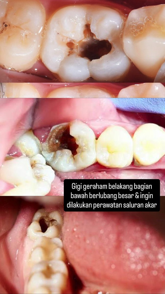 UNDIP MENFESS tweet media