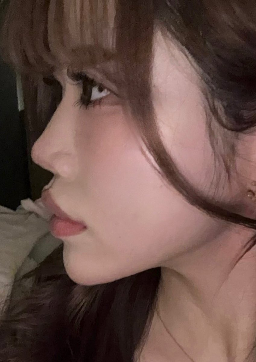 bBHM2aA1uPmrZvq's tweet photo. 鼻が綺麗になるだけで人生変わった🥹✨️
The整形鼻じゃなくて、自然で本当に綺麗な仕上がりにしてもらいました！！！！
BIKAN整形外科のパク先生にお願いして本当に良かったです🤍 https://t.co/Y7q8GnJEOd