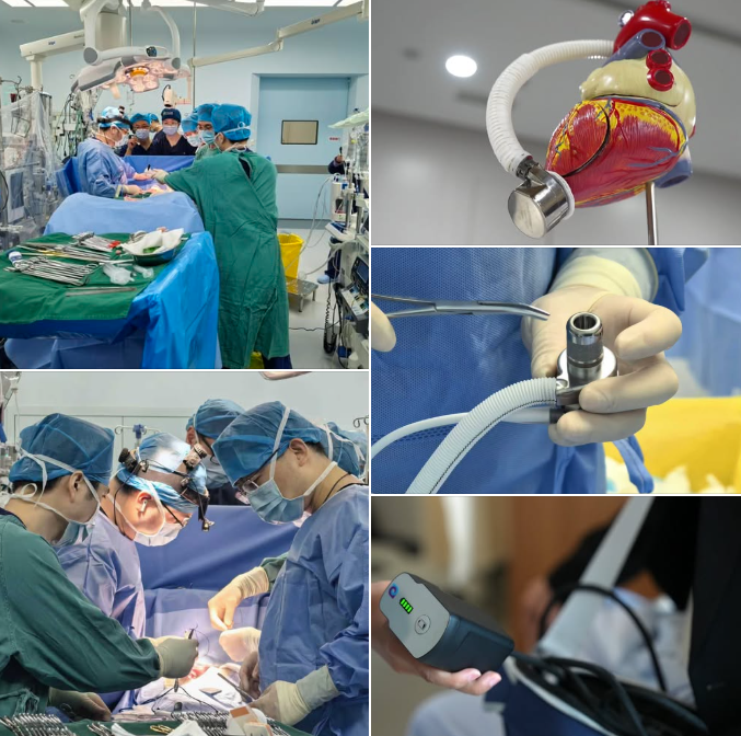 China’s achievement  
Only 90 grams!  
Lighter than an apple!  
The world’s lightest fully magnetic‑levitation artificial heart is now in service to benefit humanity.