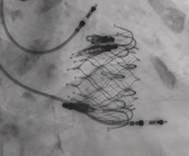 Dabit Arzamendi tweet media